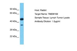 TMEM168 Rabbit anti-Human, Polyclonal, Novus Biologicals 0.1 mL | Buy Online | Novus Biologicals | Fisher Scientific